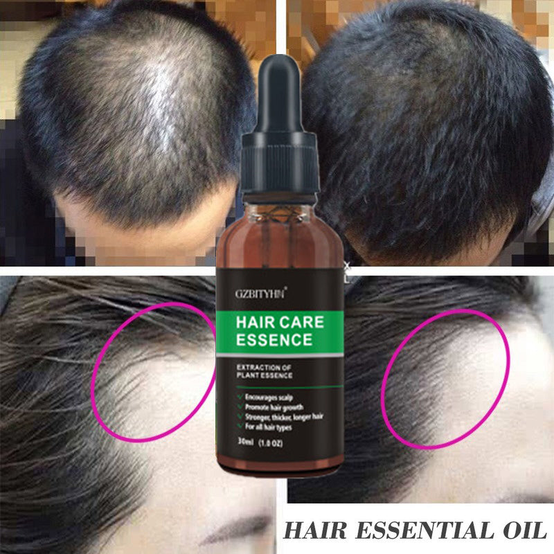 VitalGrow Hair Growth Oil